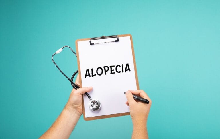 Tipos de alopecia ¿Cuáles son los principales?
