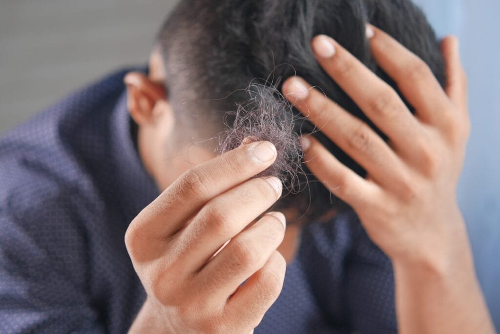 Un hombre con un principio de Alopecia nerviosa