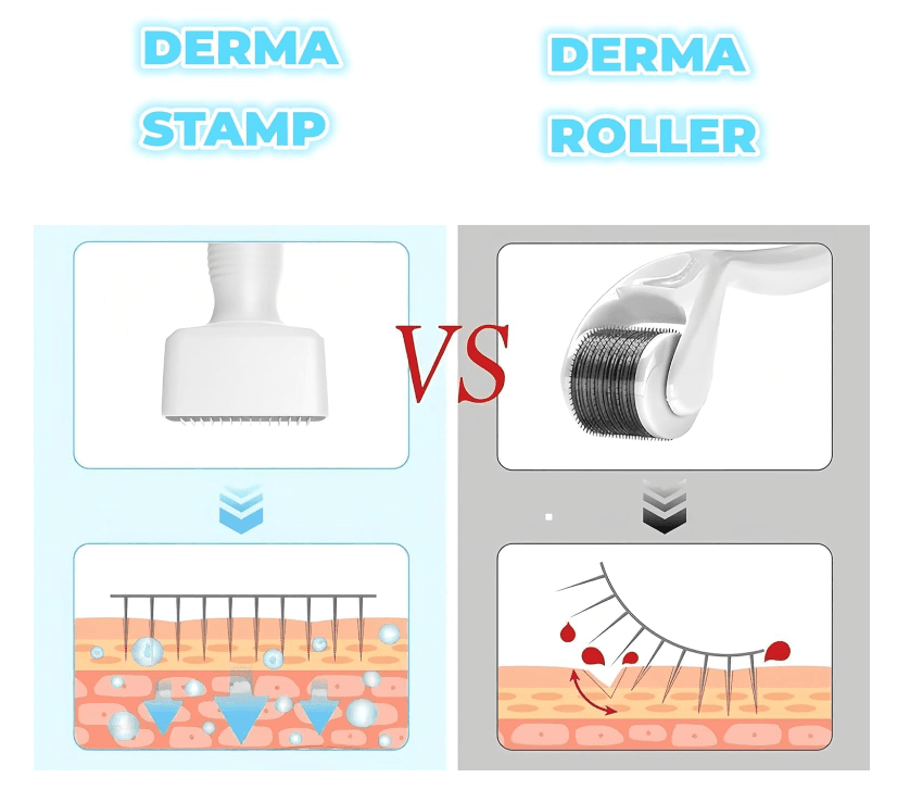 Comparación gráfica de los efectos del dermastamp y dermaroller en la piel, mostrando cómo cada dispositivo de microneedling actúa en diferentes capas para tratar la caída del cabello.