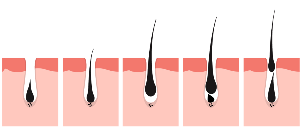 Diagrama ilustrativo de las fases de crecimiento del cabello: anágena (fase de crecimiento), catágena (fase de transición) y telógena (fase de reposo), mostrando el ciclo del folículo piloso."